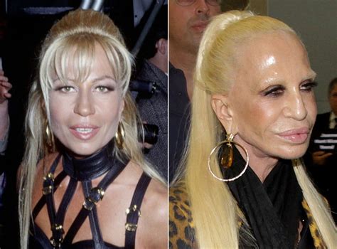 versace antonella protesi|donatella versace avant chirurgie.